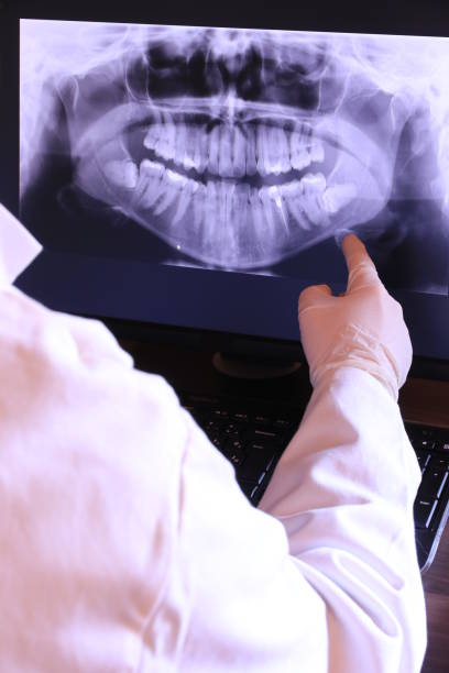 Best Emergency Dentist for Lost Fillings or Crowns in Level Plains, AL