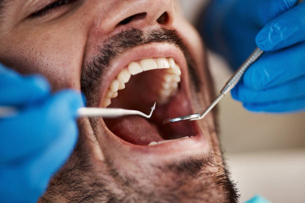 Fast & Reliable Emergency Dental Services in AL